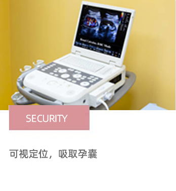 无痛人流方式 超导定位