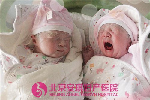 北京安琪妇产医院双胞胎