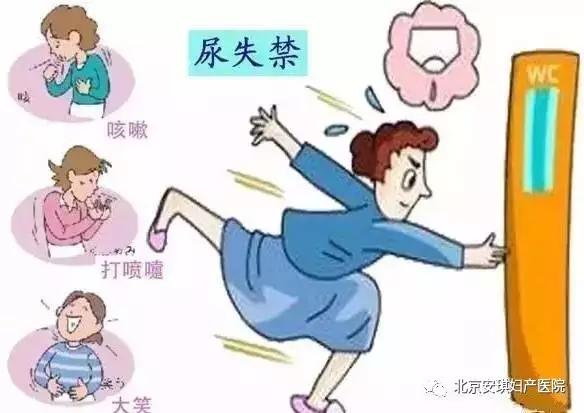 北京安琪妇产医院盆底肌